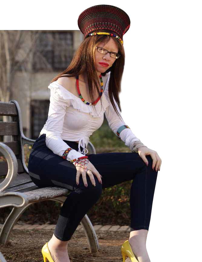Lerato Sithibe is at the forefront of raising awareness about albinism.