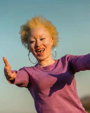 Regina Mary Ndlovu uses acting to educate about albinism.